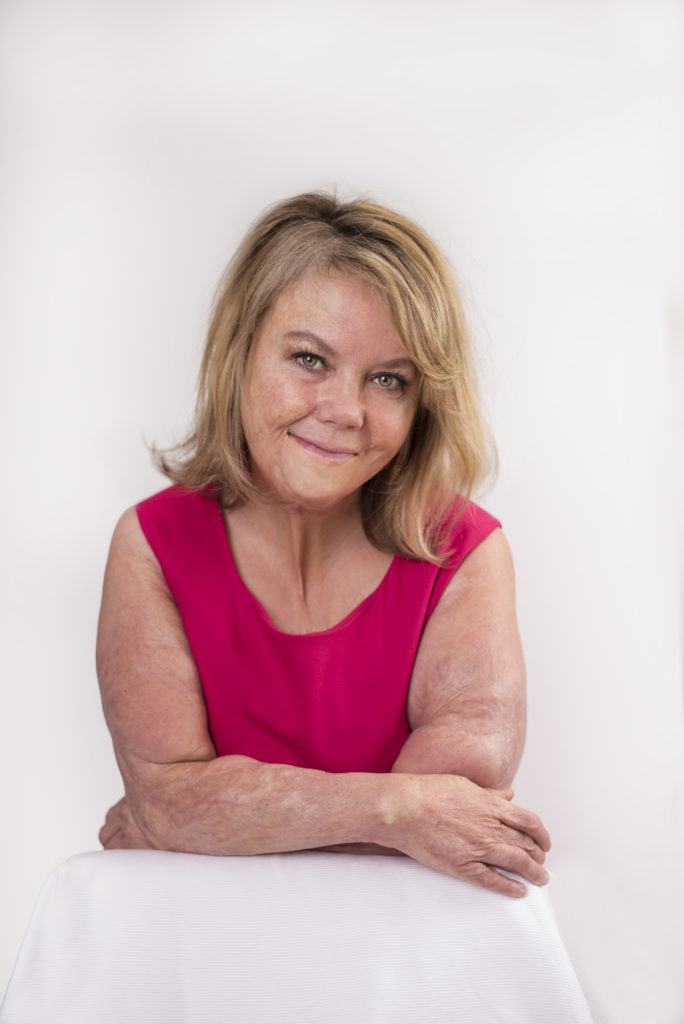 U.g.l.y. is Still Beautiful | Kelly Falardeau | Tedxualberta